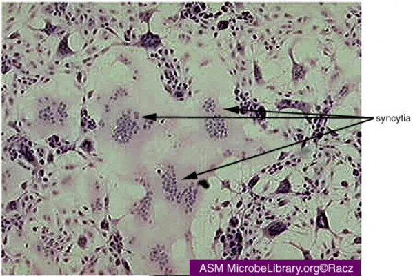 Syncytia formation - Syncytia formation