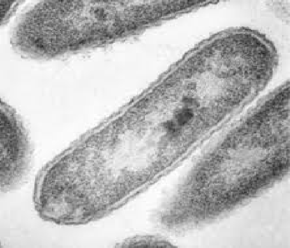TEM image showing thin section of bacteria
