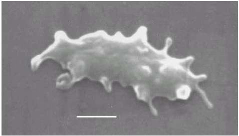 - ThermoplasmaPhoto by Dr. William Hixon