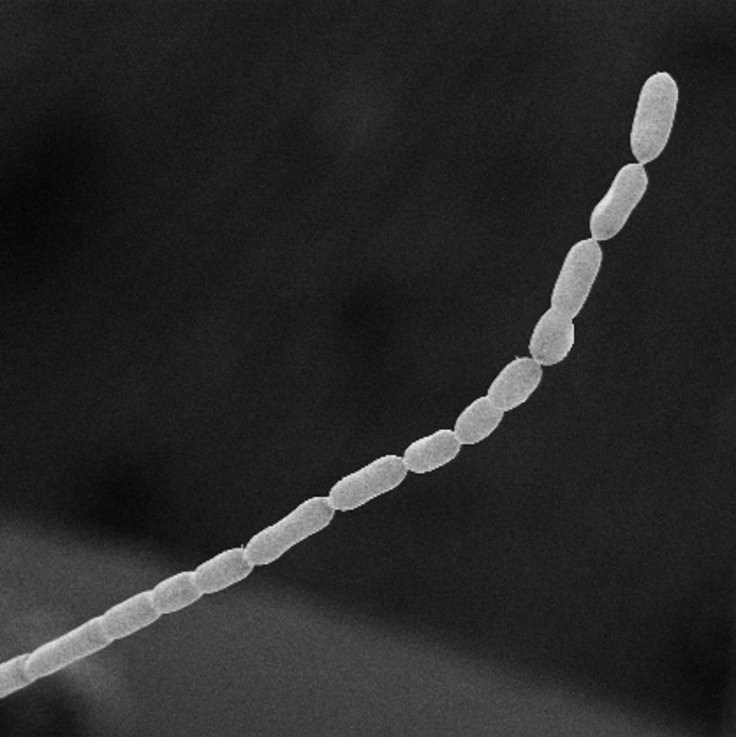 Thiomargarita magnifica (facts of microorganisms) - This microscope photo provided by the Lawrence Berkeley National Laboratory in June 2022 shows part of a Thiomargarita magnificabacteria cell.  Université des Antilles via AP