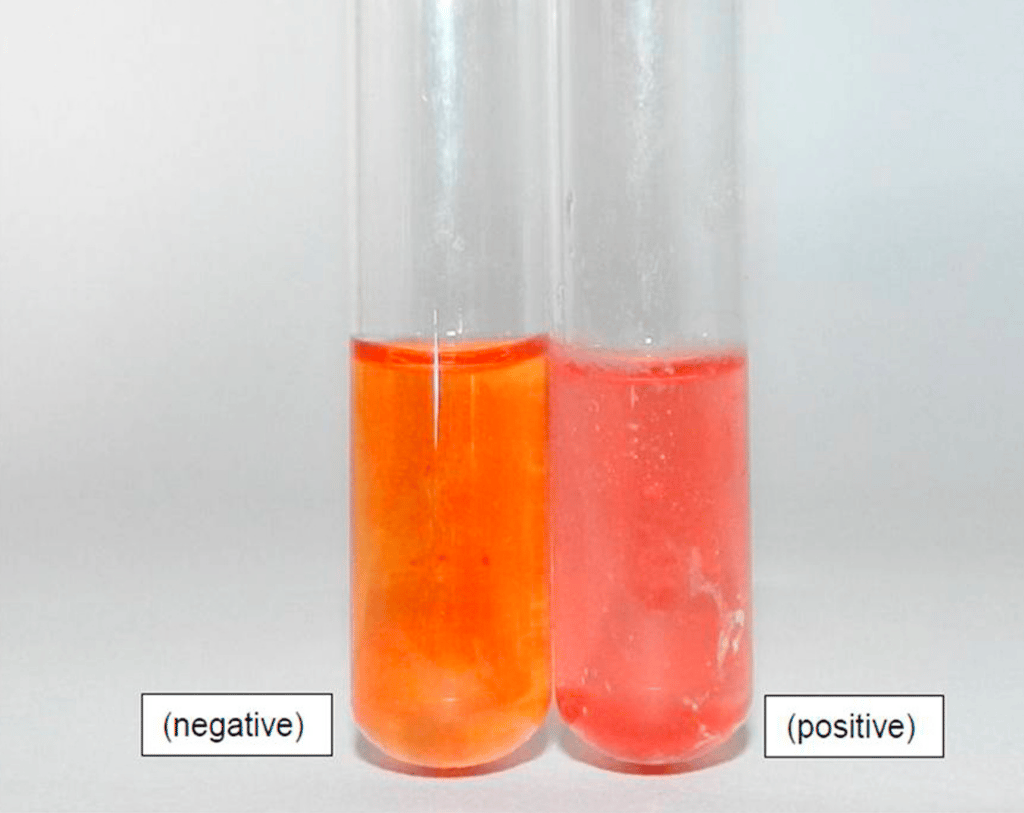 Tween-80 hydrolysis test - Tween-80 hydrolysis test