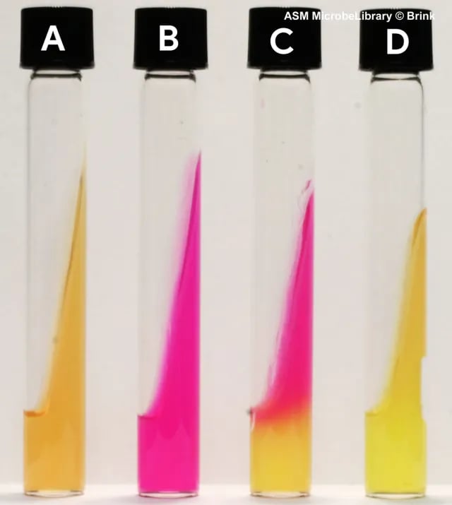 Urease Test