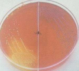 Xylose Lysine deoxycholate (XLD) Cultures.  - Xylose Lysine deoxycholate (XLD) Cultures.Left: YellowEscherichia colicolonies Right: Red-pinkSalmonellacolonies (SomeProteusspecies look identical)