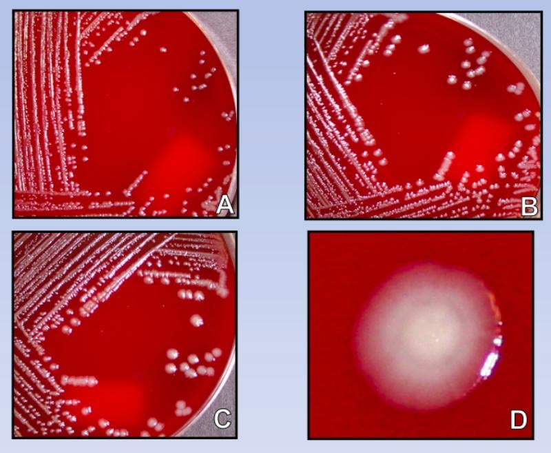 - Yersinia pestisgrowth on Blood Agar A. 48 hours, B. 72 hours, C. 96 hours, and D. 96 hours “fried egg”