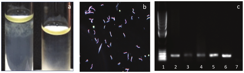 - (a) Growth from blood in EMJH semisolid mediaLeptospirais forming subsurface colonies in the tube on the left and no growth in the tube on the right; (b) dark field microscopy image of the culture showing spirochetes with morphology compatible with Leptospira; (c) Conventional PCR targeting lipL32 gene  (Image source: Christopher Ryan Larson)