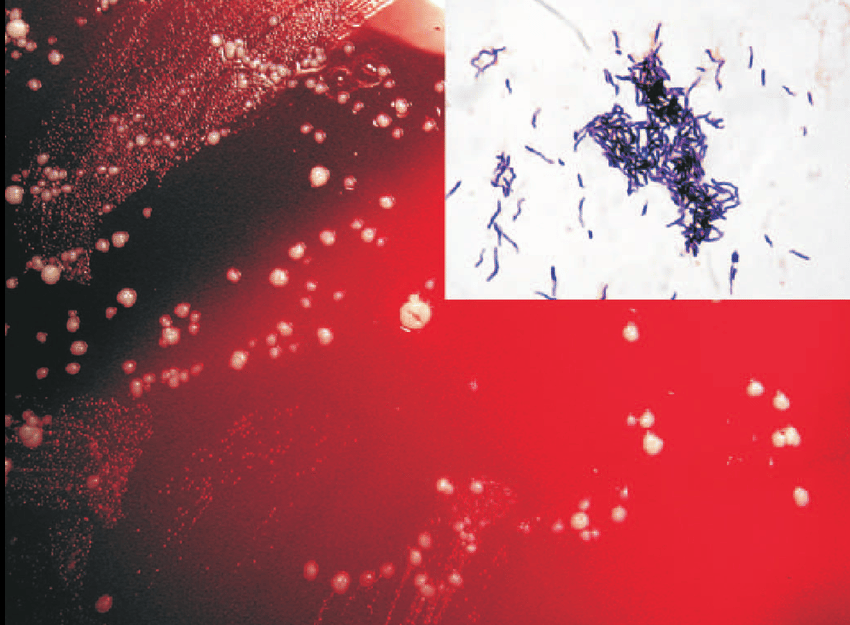 - Actinomycesin culture and Gram-stain