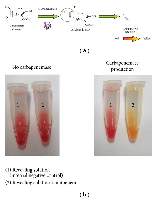 Carba np test result