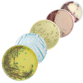 - Chromogenic Agar Media (Source:biomerieux)
