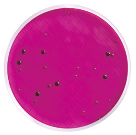 Coliform colonies with green metallic sheen