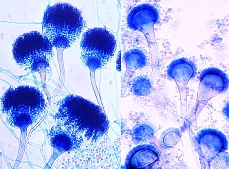 - Conidial heads ofA.fumigatus.Note:uniseriaterow of phialides on the uppertwo thirdsof the vesicle.(Source)