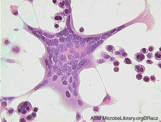 Cytopathic effect HSV
