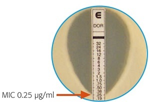 MIC by E-Test - E-Test showing MIC