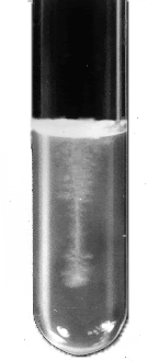 Fir tree appearance of Bacillus anthracis colonies  - Inverted fir tree appearance