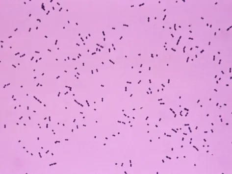 gram positive cocci streptococcus - Gram positive diplocci: Streptococcus spp