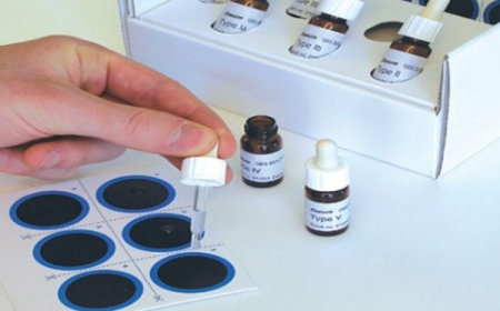 Heterophile antigen
