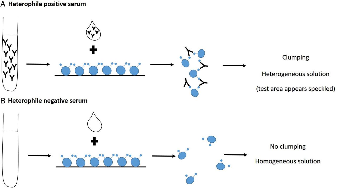 - Heterophile-antibody test