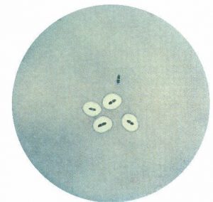 Result of Quellung Reaction - Result of Quellung Reaction