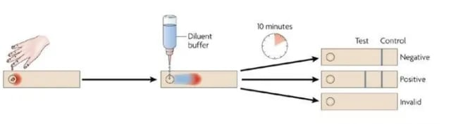 rK39 test process - rk 39 Test