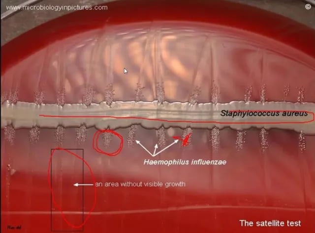 - Satellitism test for the identification ofHaemophilus influenzae(Image source: microbiologypictures.com)