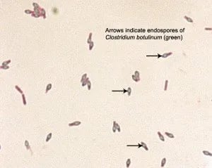 Spore of Clostridium botulinum Source: ASM - Spore ofClostridium botulinumSource: ASM