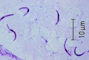 Sporozoite (infecive stages)  - Sporozoite of Malarial Parasite