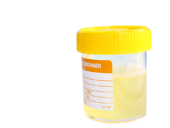 Urine for fungal
