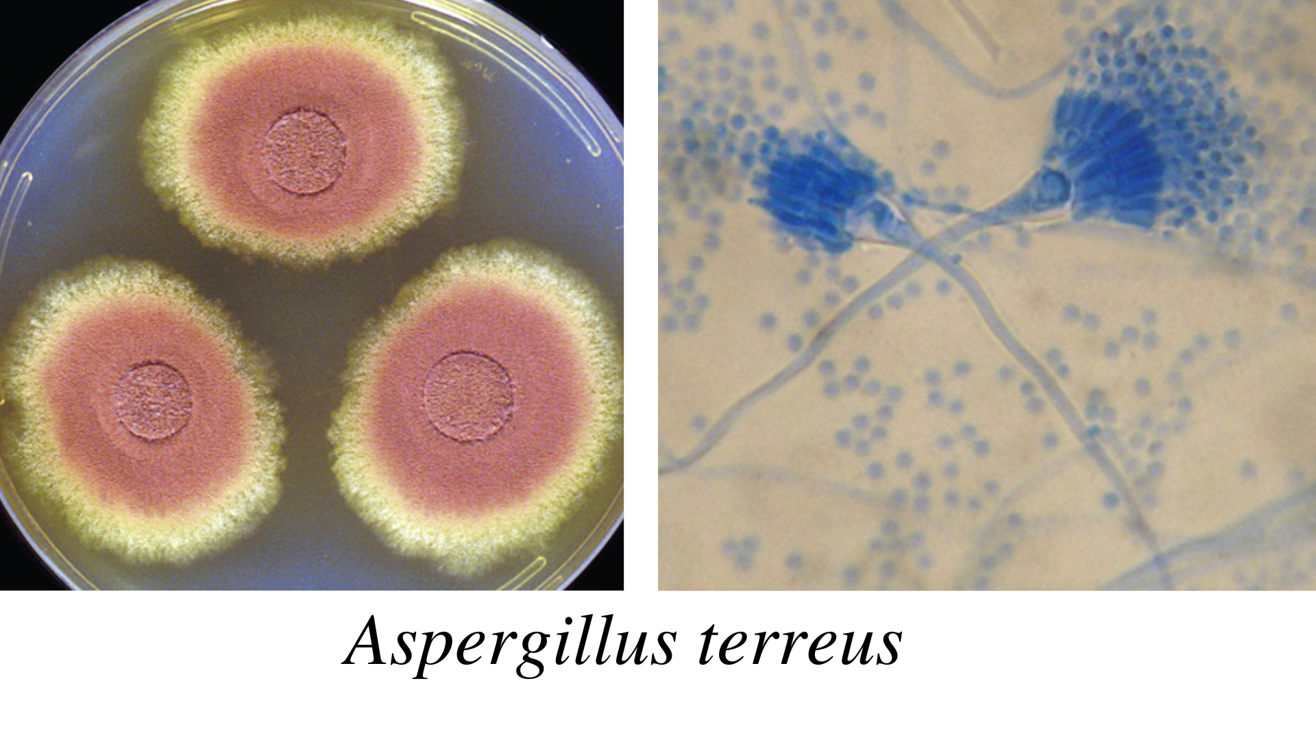 Aspergillus terreus - Aspergillus terreus