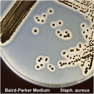 Colonies of Staphylococcus aureus in Baird Parker Agar Medium - Colonies of Staphylococcus aureus in Baird Parker Agar Medium