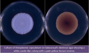 Histoplasma capsulatum culture in SDA Source:http://www.mycology.adelaide.edu.au/ - Histoplasma capsulatumculture inSDASource: http://www.mycology.adelaide.edu.au/