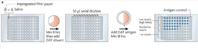Direct Agglutination Test (DAT) for Kala Azar Diagnosis - DAT Test for the diagnosis of Visceral Leishmaniasis