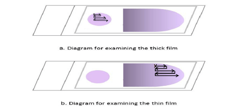 - Examining the thin blood films