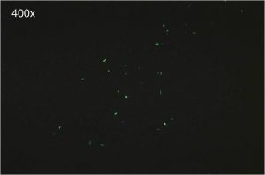 Fig:Fluorochrome stained smear showing numerous green acid fast bacilli - Fig: Fluorochrome stained smear showing numerous green acid-fast bacilli