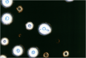 India ink preparation of CSF sample  - Image-1: India ink preparation of CSF sample