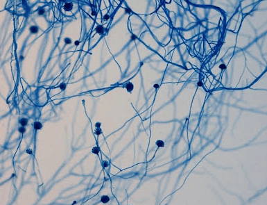 LPCB - Aspergillus flavuson LPCBImage source:Yuri