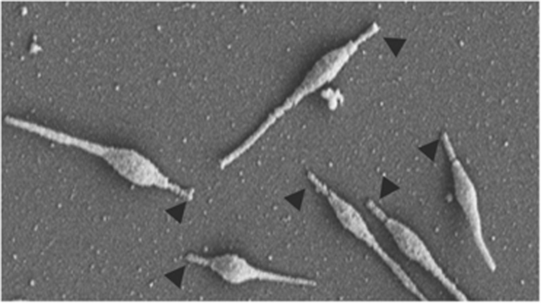 - Scanning electron micrograph ofMycoplasma pneumoniaecells(Source)