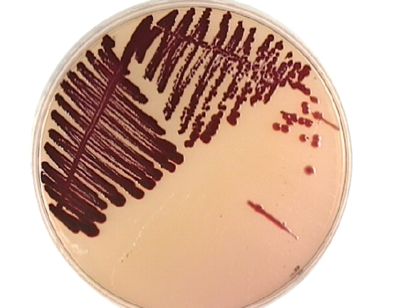 Serratia marcescens in MacConkey Agar  - Dark red colonies ofSerratia marcescensin MacConkey Agar