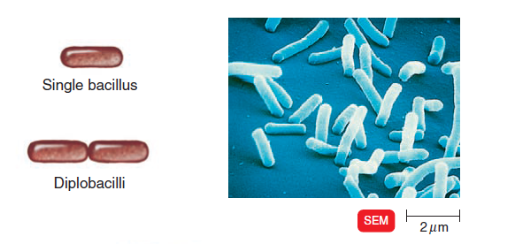 - Single bacillus and Diplobacilli (Image source: Ref-3)