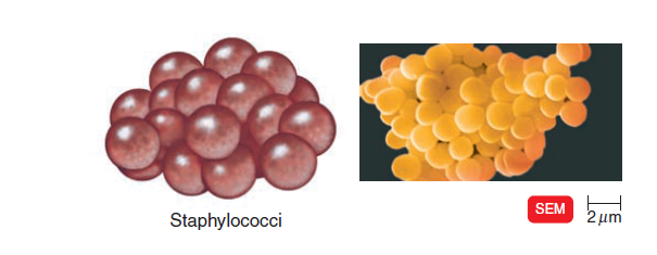 - Staphylococci (grapes-like cluster) (Image source: Ref-3)