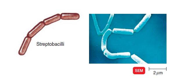 - Streptobacilli (Image source: Ref-3)