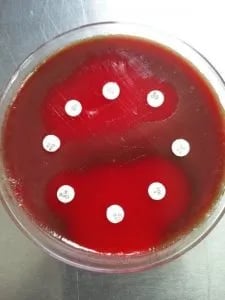 Antimicrobial sensitivity testing of Streptococcus pneumoniae  - Antimicrobial sensitivity testing ofStreptococcus pneumoniae