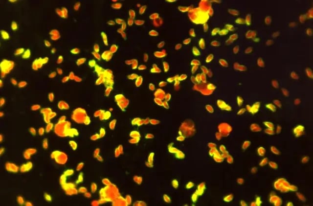 Fluorescent antibody-stained specimen showing numerous, Toxoplasma sp. tachyzoite - Fluorescent antibody-stained specimen showing numerousToxoplasmasp. tachyzoite(Image credit: CDC)