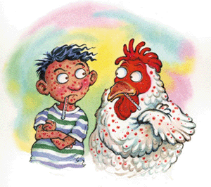 chicken pox cartoon - Chicken pox?
