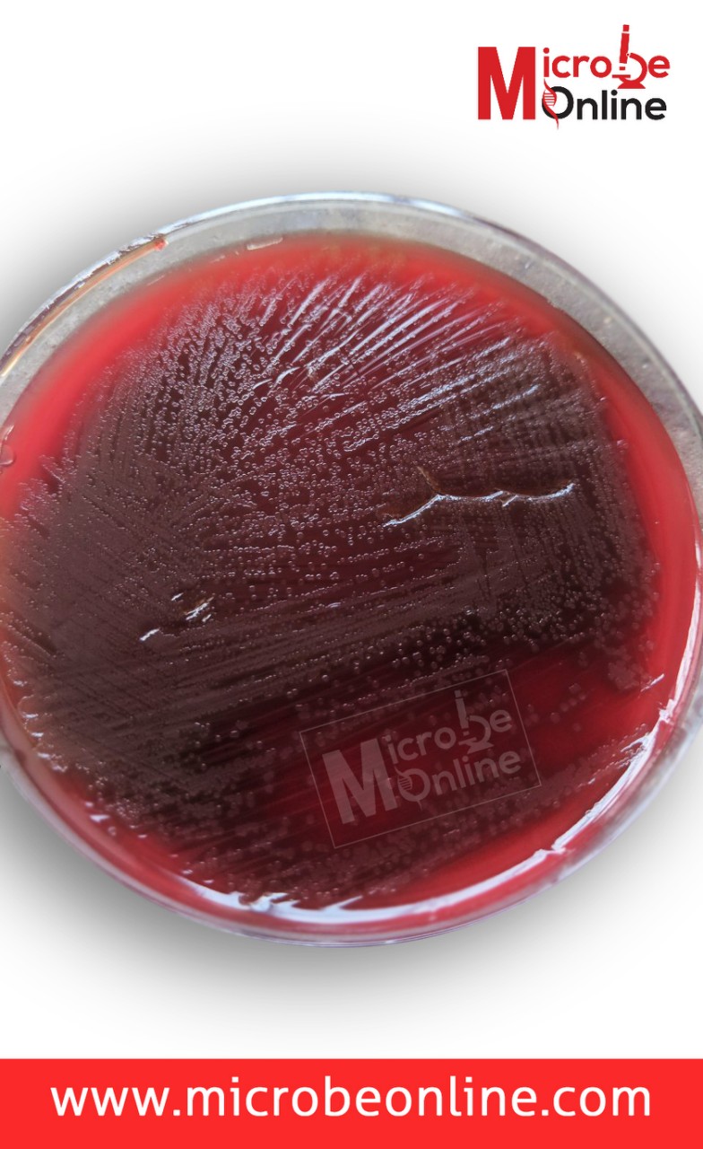 - Draughtsman colonies ofS.pneumoniae