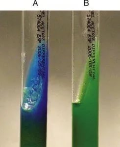 Acetate Utilization Test: Principle, Procedure, Results, Uses