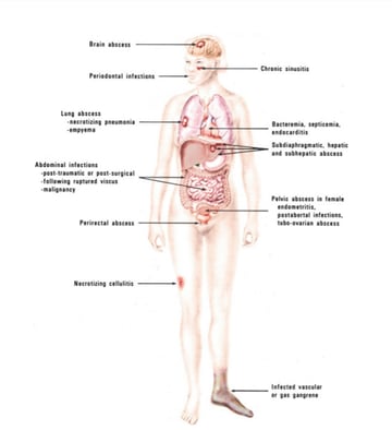 Anaerobic Infections: Causes, Where Anaerobes Live, Symptoms, Diagnosis