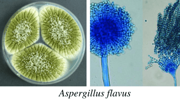Aspergillus: Species Identification, Aspergillosis, and Lab Diagnosis