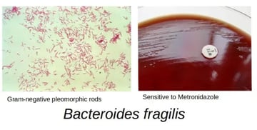 Bacteroides fragilis: Anaerobe, Capsule, Abscesses, Diagnosis, Treatment