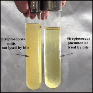 Bile Solubility Test: Principle, Procedure, Results