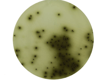 Bismuth Sulfite Agar (BS Agar): Composition, Principle, Uses, and Colony Morphology