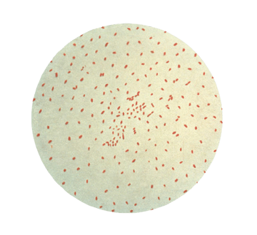 Bordetella pertussis: Whooping Cough, Pertussis Toxin, Diagnosis, Treatment